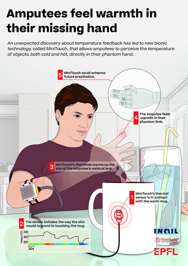 Prosthetics That Can Feel, Thanks to the Science of Touch