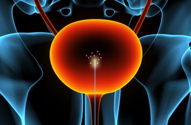 engineering careers Nanotube Catheter Cancer Detection: MIT’s Molecular Camera Spots Bladder Tumours 50,000 Times Better Than Standard Tests
