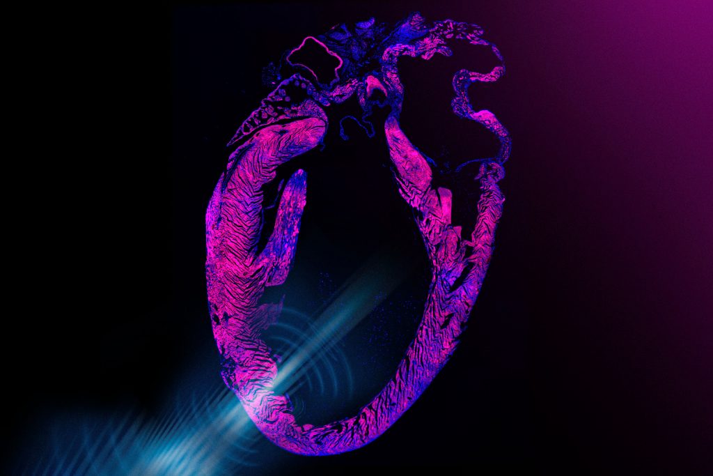 Ultrasound Wearable Pacemaker Developed by MIT Engineers